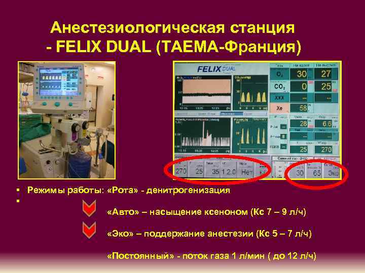    Анестезиологическая станция   - FELIX DUAL (TAEMA-Франция) § Режимы работы: