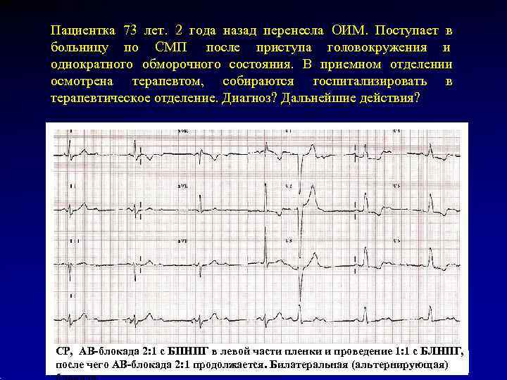 Пациентка 73 лет. 2 года назад перенесла ОИМ. Поступает в больницу по СМП после