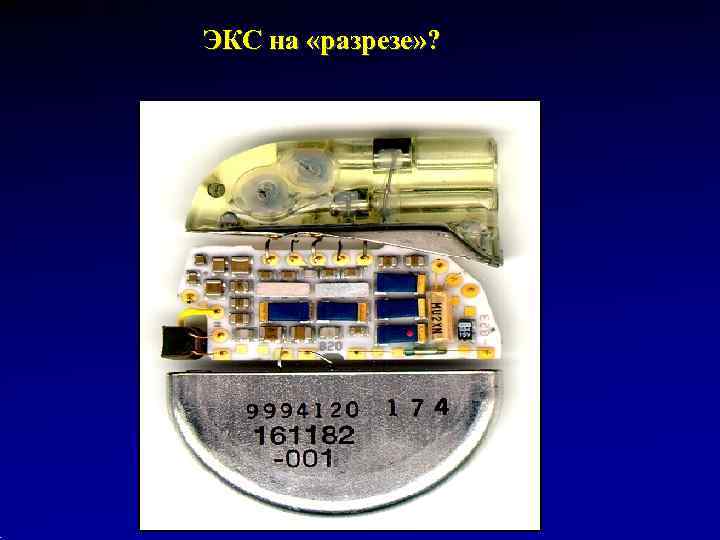 ЭКС на «разрезе» ? 