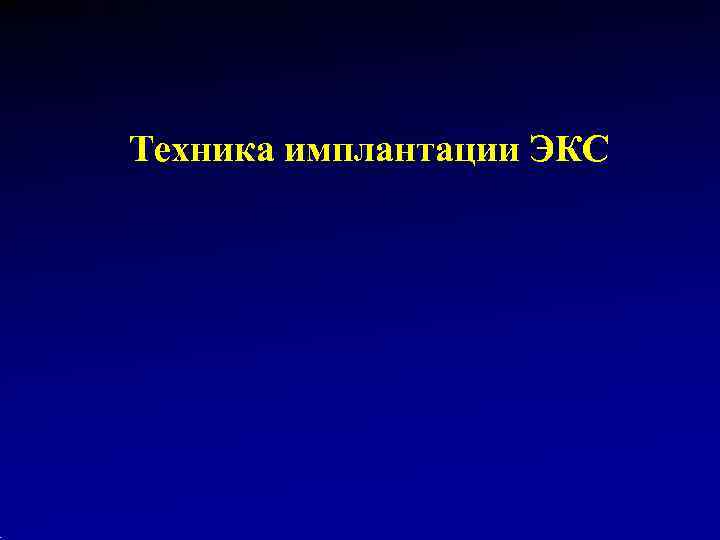 Техника имплантации ЭКС 
