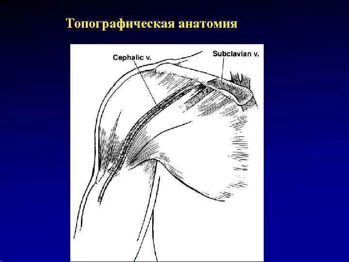 Топографическая анатомия 