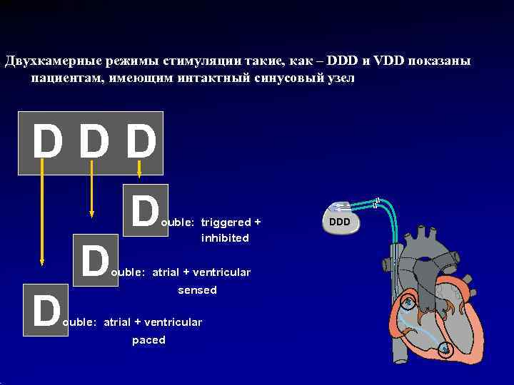 Двухкамерные режимы стимуляции такие, как – DDD и VDD показаны  пациентам, имеющим интактный