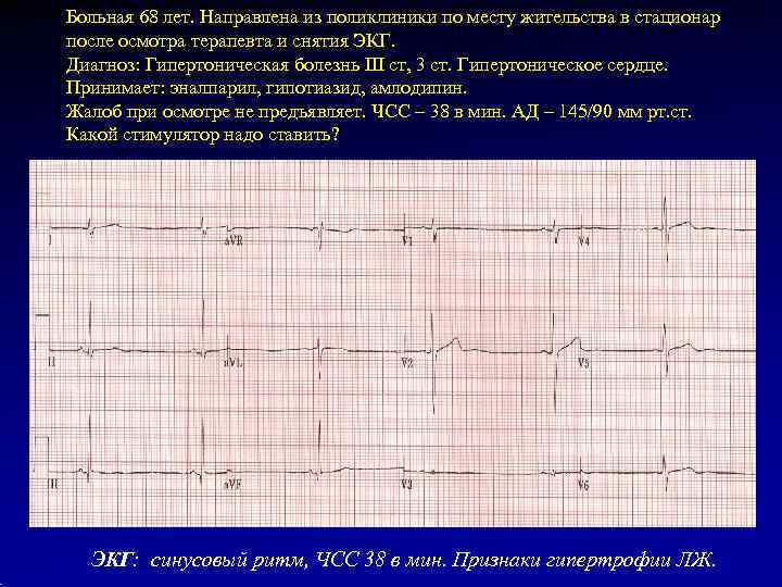 Больная 68 лет. Направлена из поликлиники по месту жительства в стационар после осмотра терапевта