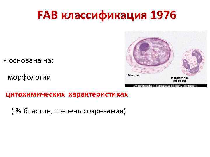    FAB классификация 1976  •  основана на: морфологии  цитохимических