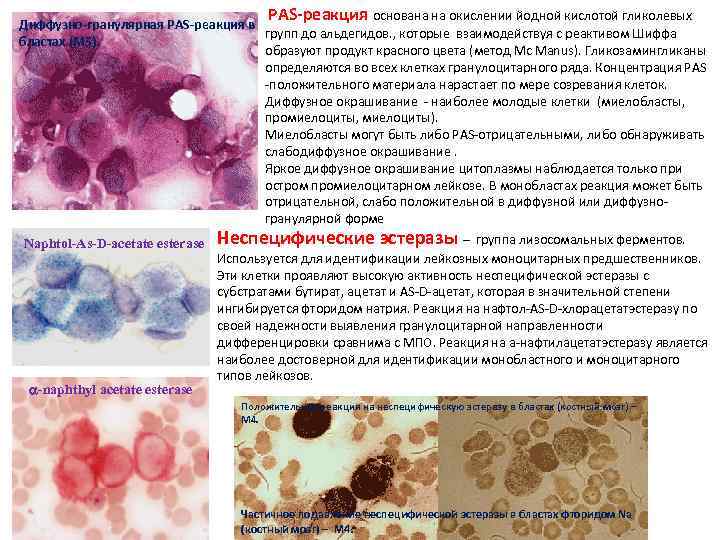       РАS-реакция основана на окислении йодной кислотой гликолевых Диффузно-гранулярная