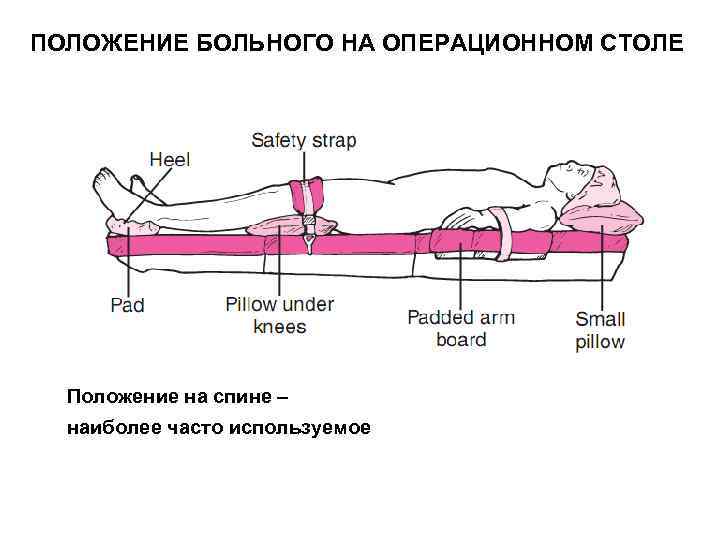 ПОЛОЖЕНИЕ БОЛЬНОГО НА ОПЕРАЦИОННОМ СТОЛЕ  Положение на спине –  наиболее часто используемое