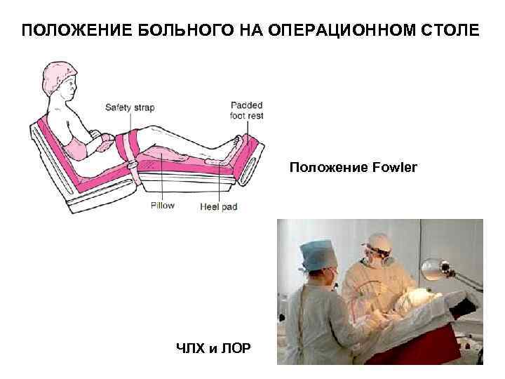 Виды положения пациента на операционном столе