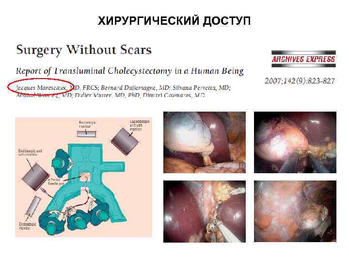 ХИРУРГИЧЕСКИЙ ДОСТУП 