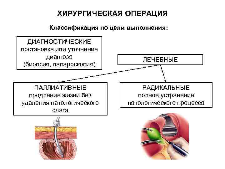   ХИРУРГИЧЕСКАЯ ОПЕРАЦИЯ   Классификация по цели выполнения: ДИАГНОСТИЧЕСКИЕ постановка или уточнение