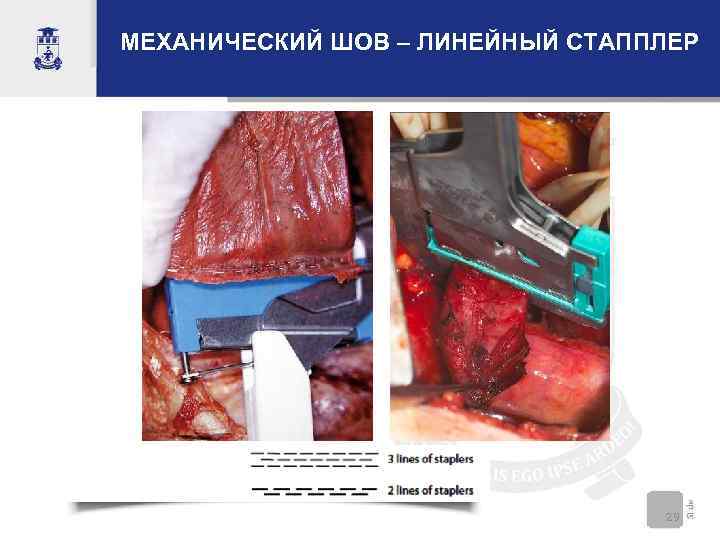 МЕХАНИЧЕСКИЙ ШОВ – ЛИНЕЙНЫЙ СТАППЛЕР       29 