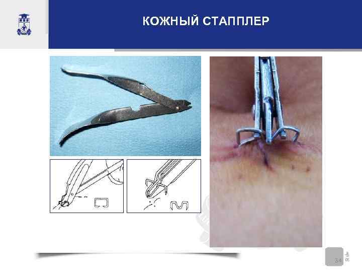 КОЖНЫЙ СТАППЛЕР    34 
