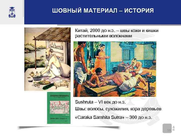 ШОВНЫЙ МАТЕРИАЛ – ИСТОРИЯ  Китай, 2000 до н. э. – швы кожи и