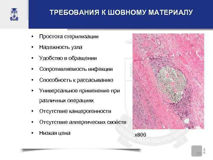   ТРЕБОВАНИЯ К ШОВНОМУ МАТЕРИАЛУ  •  Простота стерилизации •  Надежность