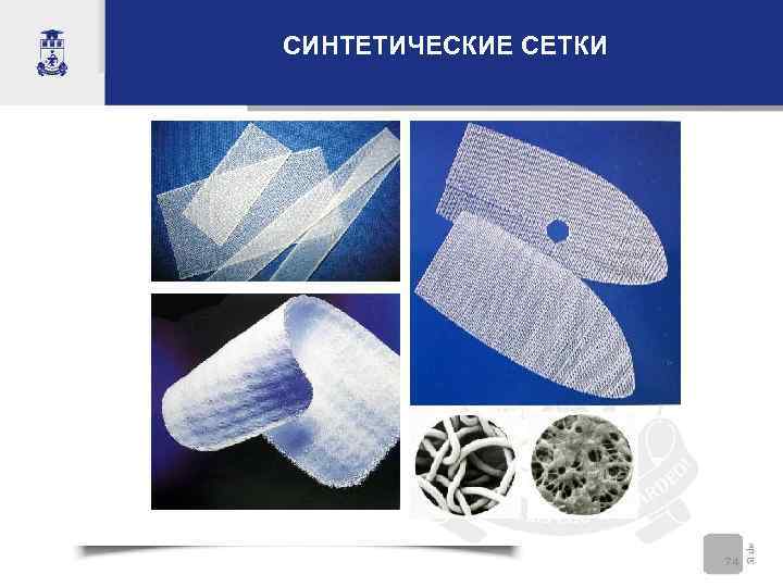 СИНТЕТИЧЕСКИЕ СЕТКИ      74 