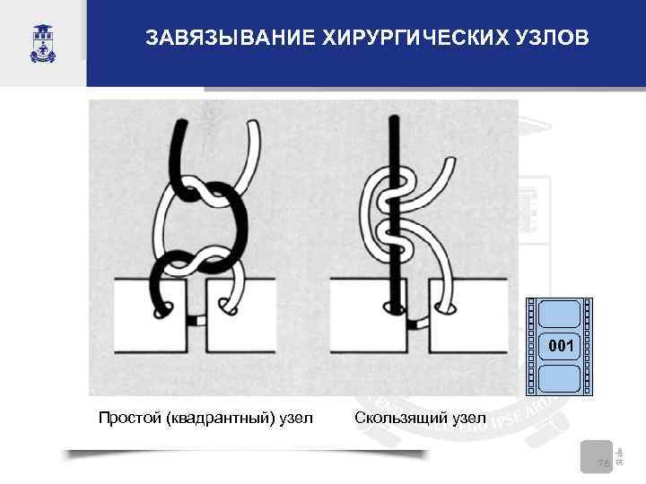  ЗАВЯЗЫВАНИЕ ХИРУРГИЧЕСКИХ УЗЛОВ     001  Простой (квадрантный) узел 