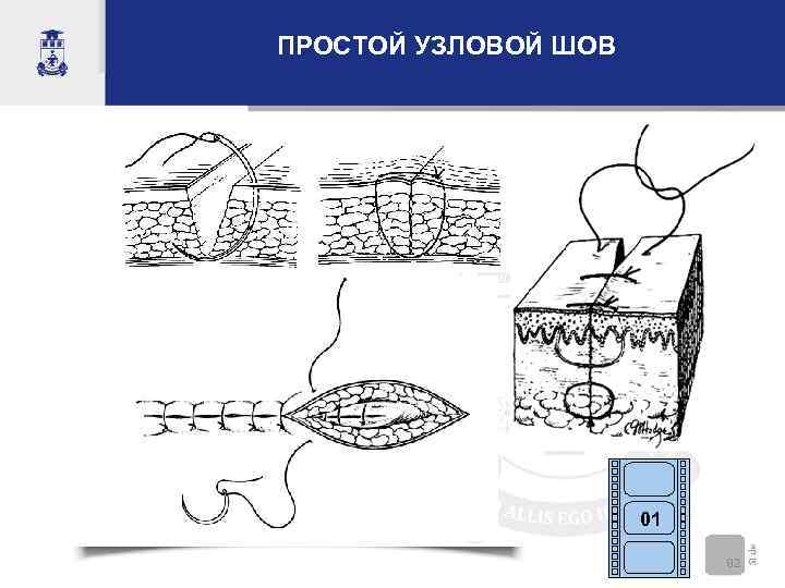 ПРОСТОЙ УЗЛОВОЙ ШОВ      01     82