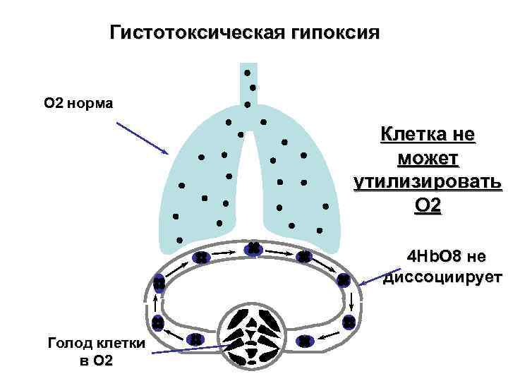   Гистотоксическая гипоксия  O 2 норма      