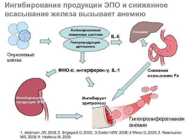 Ингибирование продукции ЭПО и сниженное всасывание железа вызывает анемию     