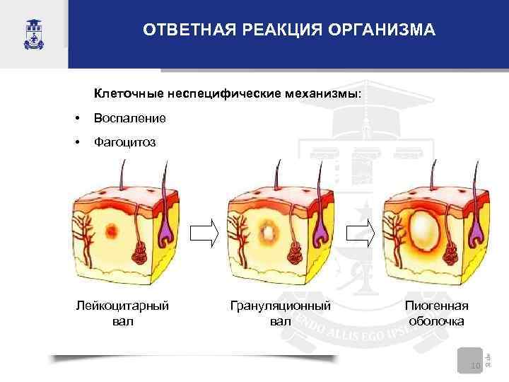   ОТВЕТНАЯ РЕАКЦИЯ ОРГАНИЗМА  Клеточные неспецифические механизмы:  •  Воспаление •