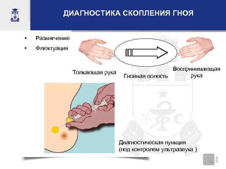 Гной при мастите фото