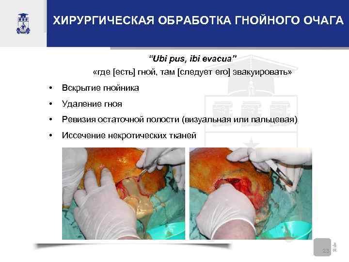   ХИРУРГИЧЕСКАЯ ОБРАБОТКА ГНОЙНОГО ОЧАГА      “Ubi pus, ibi