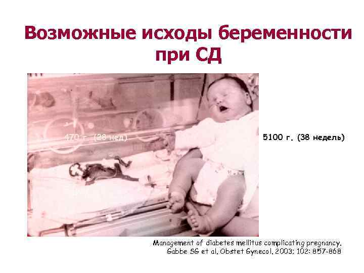 Возможные исходы беременности  при СД  470 г. (28 нед)   