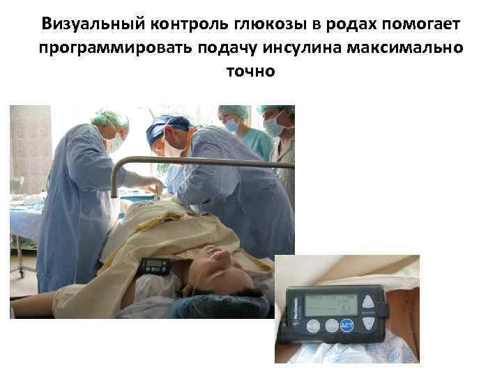 Визуальный контроль глюкозы в родах помогает программировать подачу инсулина максимально    точно