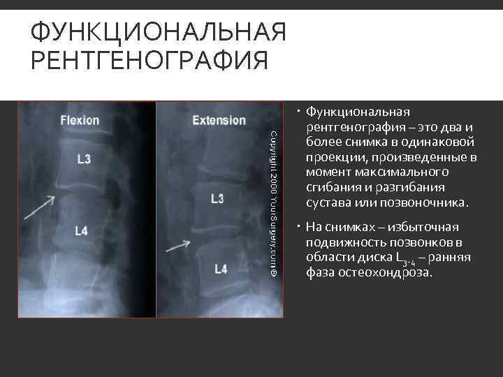 ФУНКЦИОНАЛЬНАЯ РЕНТГЕНОГРАФИЯ    Функциональная    рентгенография – это два и