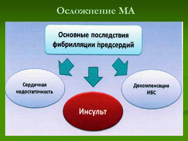 Осложнение МА 