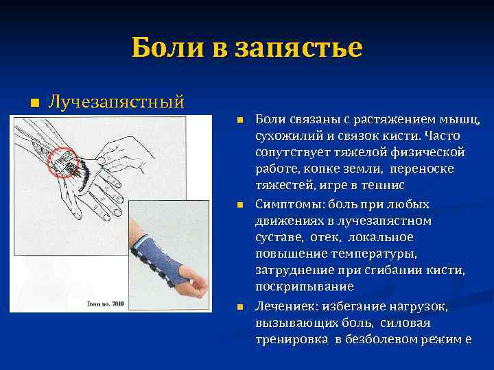   Боли в запястье n  Лучезапястный     Боли связаны