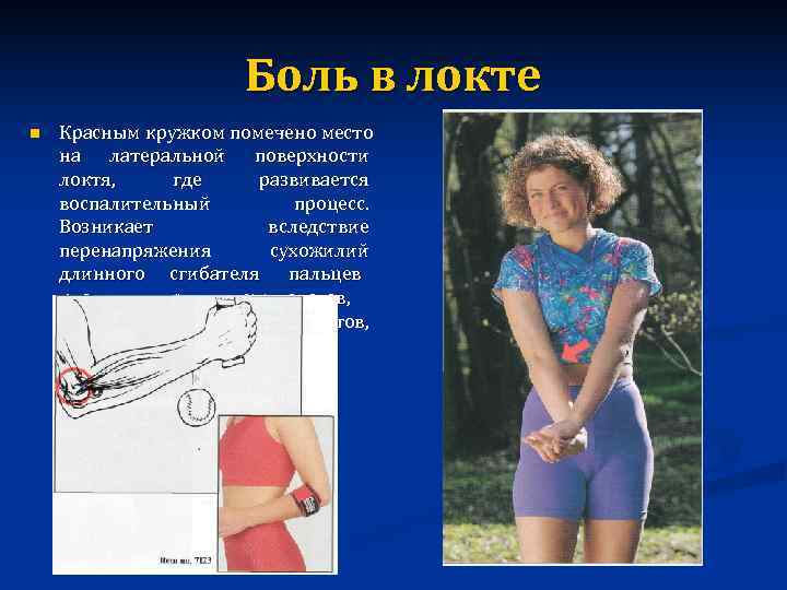      Боль в локте n  Красным кружком помечено место