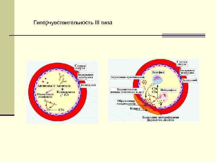 Гиперчувствительность III типа 
