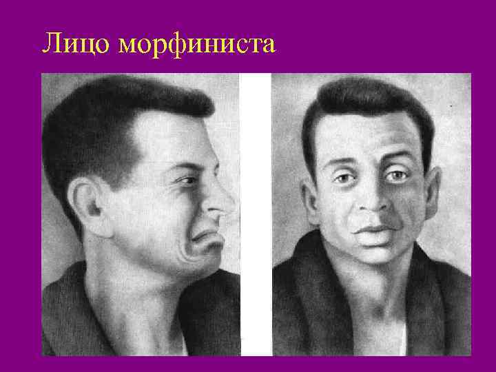 Лицо морфиниста 