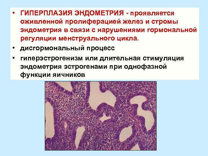 Гиперплазия эндометрии толщина