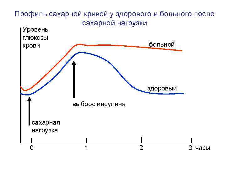 Профиль сахарной кривой у здорового и больного после   сахарной нагрузки  Уровень