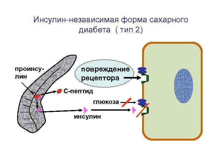  Инсулин-независимая форма сахарного    диабета ( тип 2)  проинсу- 