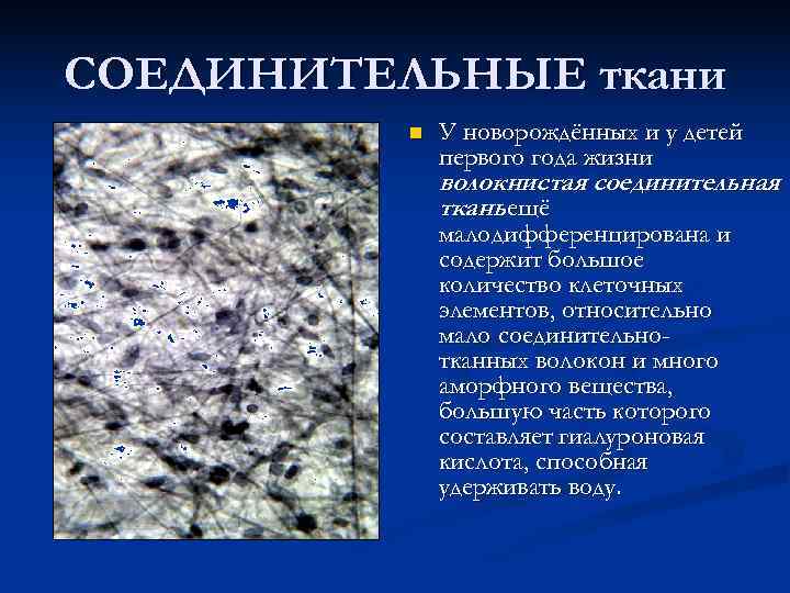 СОЕДИНИТЕЛЬНЫЕ ткани  n  У новорождённых и у детей    первого