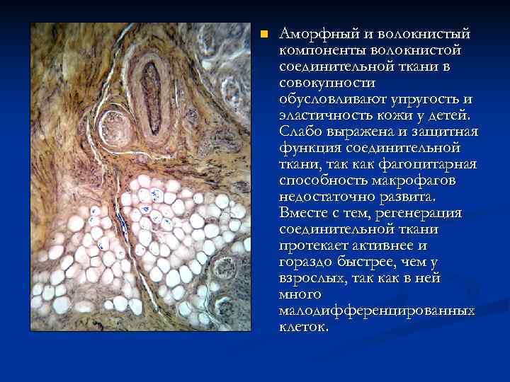 n  Аморфный и волокнистый компоненты волокнистой соединительной ткани в совокупности обусловливают упругость и