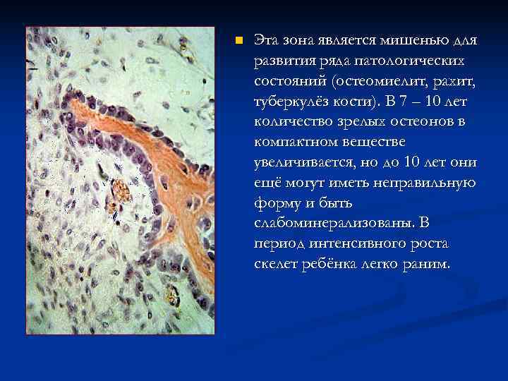 n  Эта зона является мишенью для развития ряда патологических состояний (остеомиелит, рахит, туберкулёз