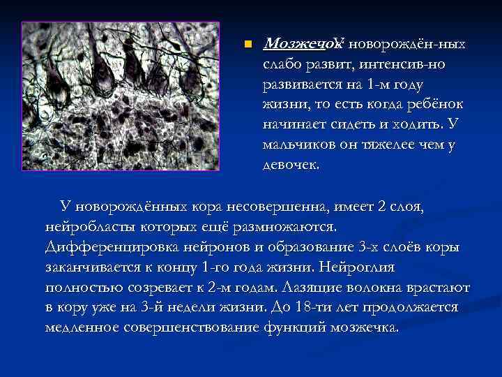      n  Мозжечок новорождён-ных     
