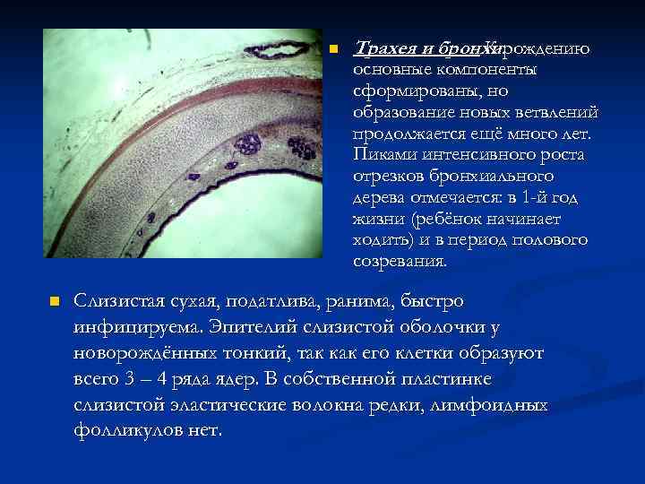      n  Трахея и бронхи. рождению   