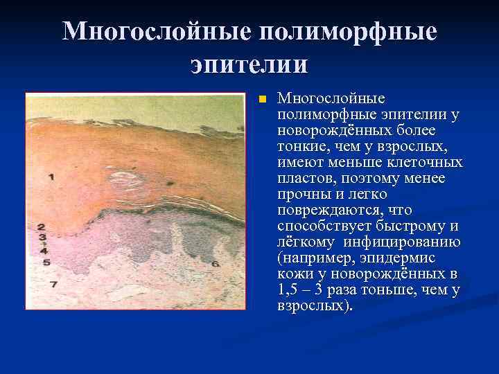 Многослойные полиморфные   эпителии   n  Многослойные   полиморфные эпителии
