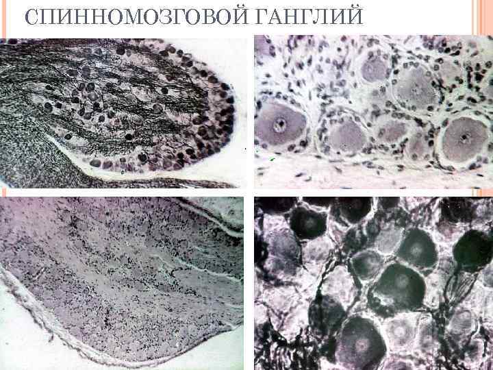 СПИННОМОЗГОВОЙ ГАНГЛИЙ 