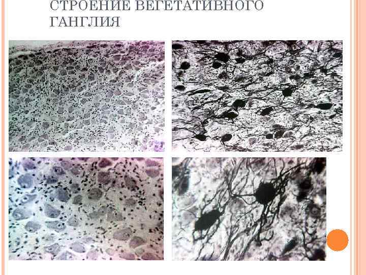 СТРОЕНИЕ ВЕГЕТАТИВНОГО ГАНГЛИЯ 