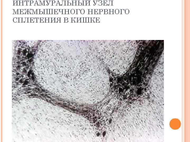 ИНТРАМУРАЛЬНЫЙ УЗЕЛ МЕЖМЫШЕЧНОГО НЕРВНОГО СПЛЕТЕНИЯ В КИШКЕ 