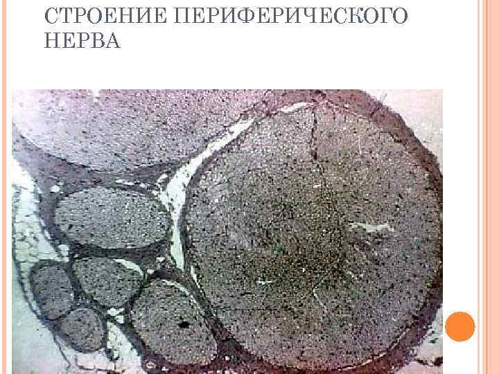СТРОЕНИЕ ПЕРИФЕРИЧЕСКОГО НЕРВА 