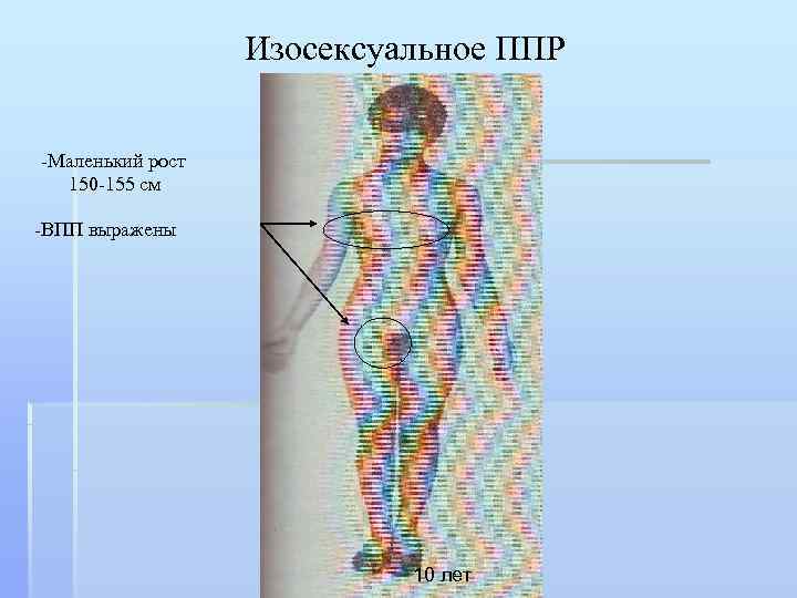 Ппр у детей. Преждевременное половое развитие девочек. Преждевременное половое созревание по изосексуальному типу. Изосексуальный Тип преждевременного полового созревания. ППР изосексуальный Тип.