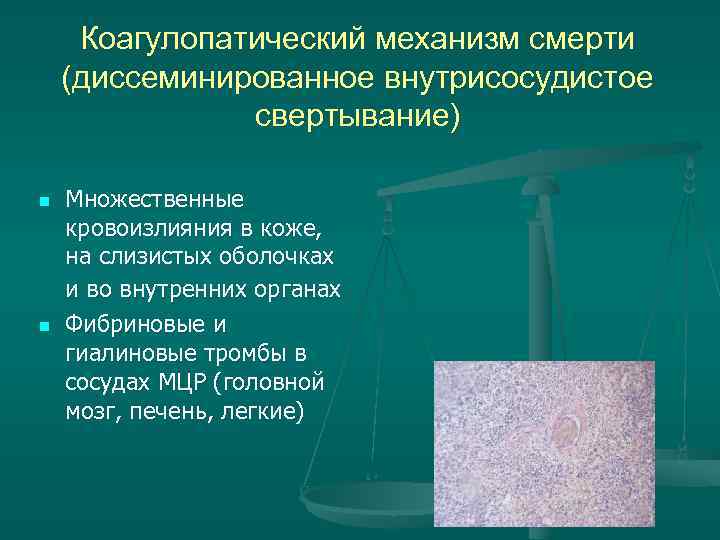 Коагулопатический механизм смерти (диссеминированное внутрисосудистое свертывание) n Множественные кровоизлияния Коагулопатический механизм смерти (диссеминированное внутрисосудистое свертывание) n Множественные кровоизлияния