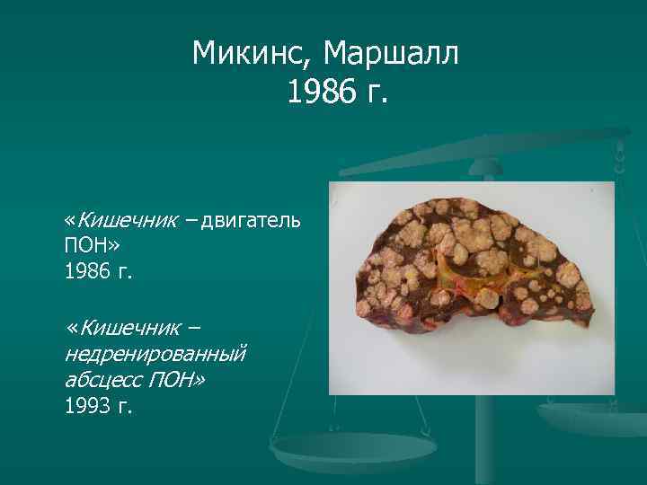 Микинс, Маршалл 1986 г. «Кишечник – двигатель Микинс, Маршалл 1986 г. «Кишечник – двигатель