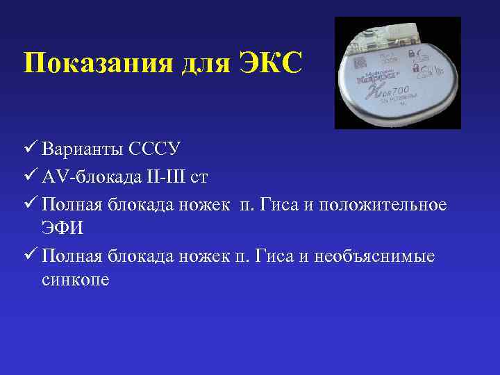 Показания для ЭКС ü Варианты СССУ ü AV-блокада II-III ст ü Полная блокада ножек